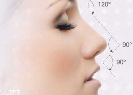 隆鼻后可以運動嗎 隆鼻手術后運動的壞處 隆鼻后可以運動嗎 隆鼻手術后運動的壞處