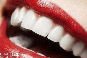 冷光美白會反彈嗎？冷光美白心得