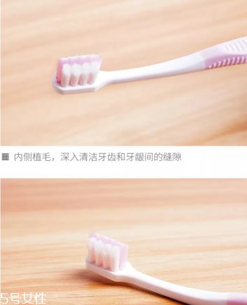 超聲波潔牙牙齒會變白嗎？超聲波潔牙心得