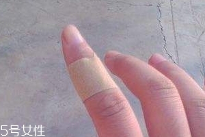 創(chuàng)可貼可以消腫嗎？創(chuàng)可貼有消腫功效嗎？