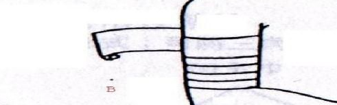 醫(yī)用紗布怎么固定？醫(yī)用紗布怎么包扎？