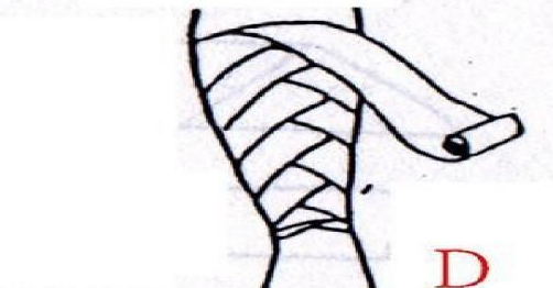 醫(yī)用紗布怎么固定？醫(yī)用紗布怎么包扎？