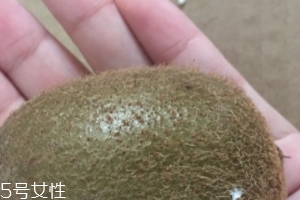 綠心獼猴桃含葉酸嗎？綠心獼猴桃里面有葉酸嗎？