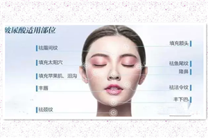 國產(chǎn)玻尿酸好嗎 國產(chǎn)玻尿酸哪些好 國產(chǎn)玻尿酸好嗎 國產(chǎn)玻尿酸哪些好