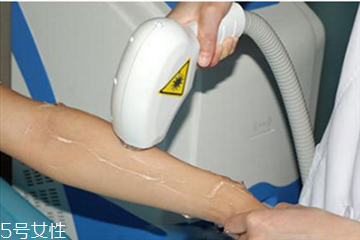 冰點脫毛危險嗎 冰點脫毛前注意什么 冰點脫毛危險嗎 冰點脫毛前注意什么