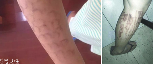 silkn脫毛儀閃光很弱的原因及解決辦法 silkn脫毛儀閃光很弱的原因及解決辦法