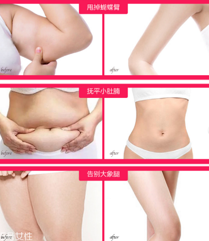 eaoron溶脂霜有用嗎 澳洲eaoron溶脂霜 eaoron溶脂霜有用嗎 澳洲eaoron溶脂霜