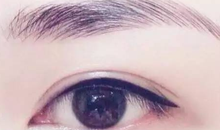 提眉和雙眼皮一起做嗎？提眉和雙眼皮要隔開(kāi)多久