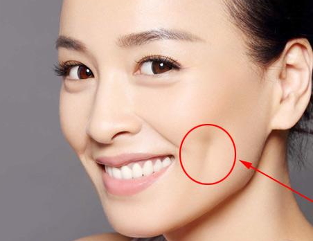 人造酒窩不笑也有嗎？人造酒窩自然嗎