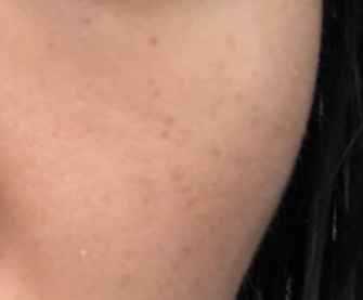 倩碧和蘭芝哪個(gè)檔次高？倩碧和蘭芝選擇