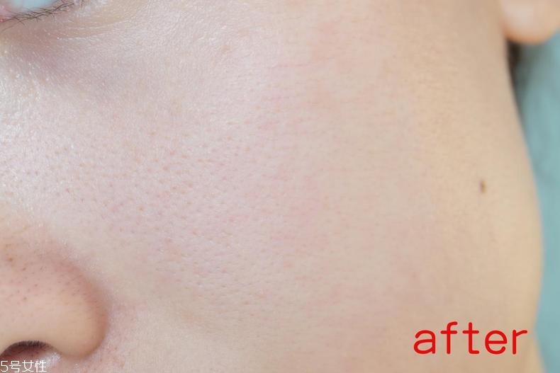 radha beauty vc精華白天能用嗎？敏感肌能用嗎？