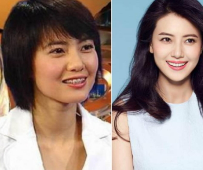 種植牙壽命是多少年？種植牙是永久的嗎