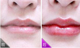 紋唇多少錢？紋唇風(fēng)險(xiǎn)大嗎