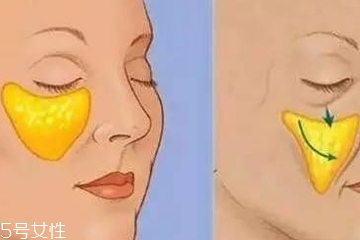 顴骨墊高手術(shù)多少錢 顴骨墊高手術(shù)費(fèi)用高嗎 顴骨墊高手術(shù)多少錢 顴骨墊高手術(shù)費(fèi)用高嗎