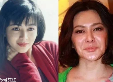 顴骨墊高手術風險大嗎 顴骨墊高會不會失敗 顴骨墊高手術風險大嗎 顴骨墊高會不會失敗