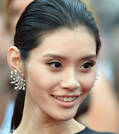 顴骨墊高手術(shù)多久能恢復(fù) 顴骨墊高多久能看到完整效果 顴骨墊高手術(shù)多久能恢復(fù) 顴骨墊高多久能看到完整效果