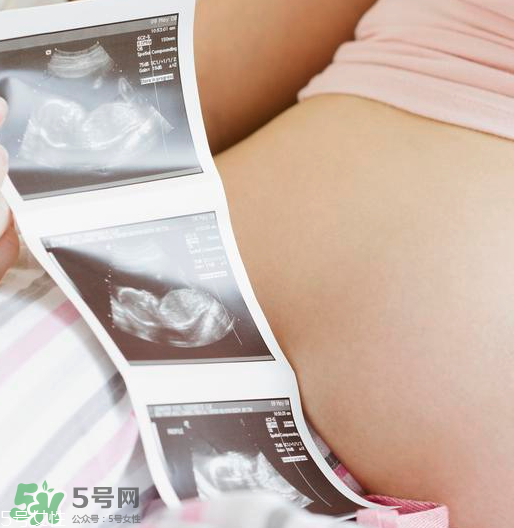 頭胎雙胞胎還能生二胎嗎？雙胞胎家庭能要二胎嗎？