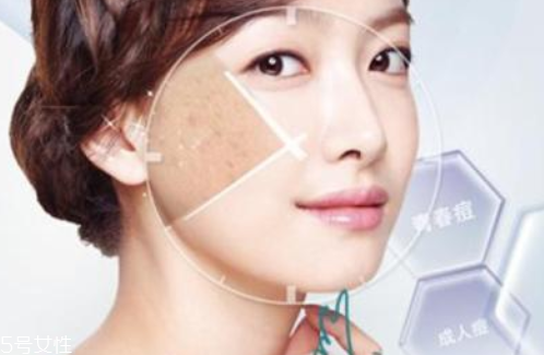 祛痘手術(shù)有哪些 4種祛痘手術(shù)哪種最好 祛痘手術(shù)有哪些 4種祛痘手術(shù)哪種最好