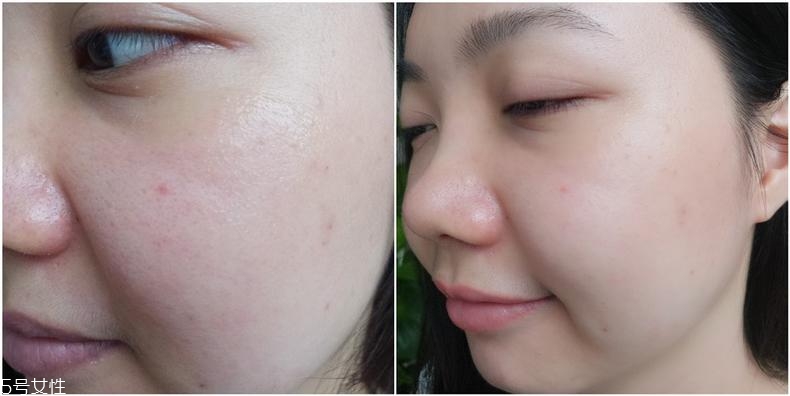 huxley仙人掌精華適合什么膚質(zhì) huxley精華3種膚質(zhì)評測 huxley仙人掌精華適合什么膚質(zhì) huxley精華3種膚質(zhì)評測