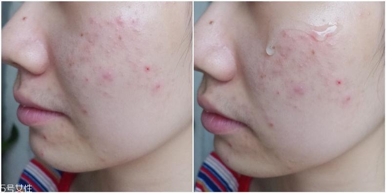 huxley仙人掌精華適合什么膚質(zhì) huxley精華3種膚質(zhì)評測 huxley仙人掌精華適合什么膚質(zhì) huxley精華3種膚質(zhì)評測