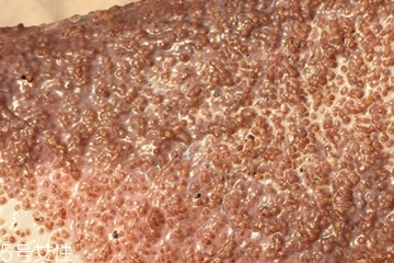 海藻面膜能去黑頭嗎？海藻面膜有去黑頭功效嗎？