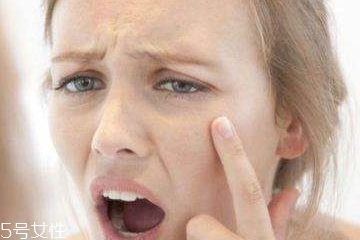 熬夜怎么預(yù)防長(zhǎng)痘痘？熬夜避免爆痘的方法