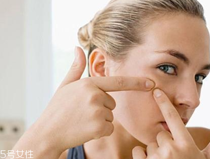 熬夜怎么預(yù)防長(zhǎng)痘痘？熬夜避免爆痘的方法