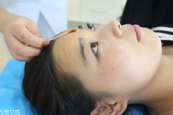 有抬頭紋怎么辦 如何去除抬頭紋 有抬頭紋怎么辦 如何去除抬頭紋