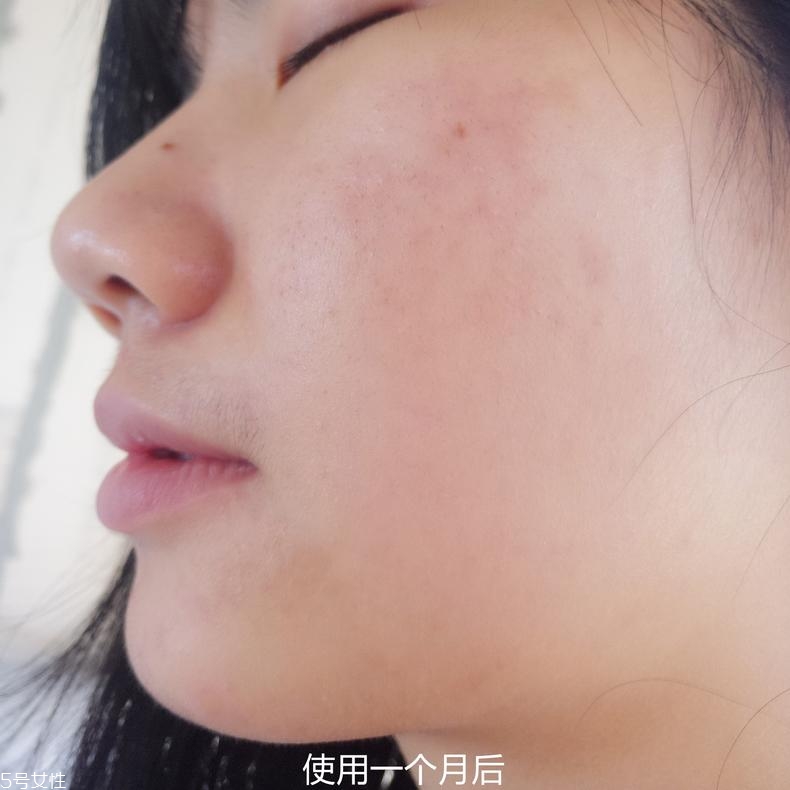 bio-e酵母精華有效嗎 1個月使用效果 bio-e酵母精華有效嗎 1個月使用效果