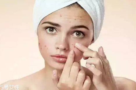 玫瑰精油怎么稀釋 玫瑰精油稀釋使用更好 玫瑰精油怎么稀釋 玫瑰精油稀釋使用更好