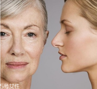 皮膚松弛怎么恢復 這樣預防皮膚松弛 皮膚松弛怎么恢復 這樣預防皮膚松弛