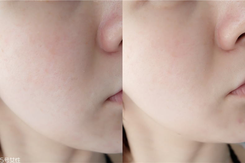 臺(tái)塑生醫(yī)產(chǎn)品不合格嗎 很安心的醫(yī)美級(jí)面膜