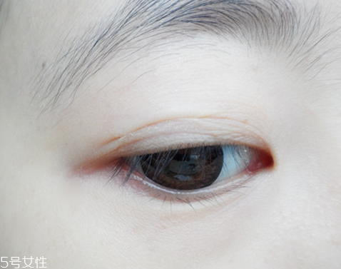 雙眼皮貼有幾種款式 雙眼皮貼有幾種款式