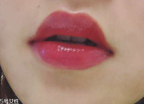 嘟嘟唇是天生的嗎 天生人工的都有 嘟嘟唇是天生的嗎 天生人工的都有