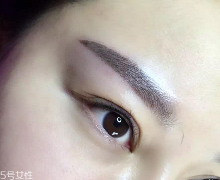 紋眉吃魚了會(huì)怎么樣 對傷口不好