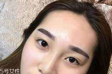 紋眉吃魚了會(huì)怎么樣 對傷口不好