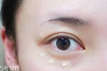 去黑眼圈用什么眼霜好 不同類(lèi)型區(qū)別對(duì)待