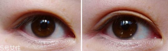 長期用假睫毛雙眼皮貼的危害 適當(dāng)減少佩戴時(shí)間 長期用假睫毛雙眼皮貼的危害 適當(dāng)減少佩戴時(shí)間