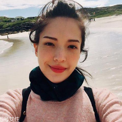 雀斑是什么原因引起的 遺傳性祛斑很難去除 雀斑是什么原因引起的 遺傳性祛斑很難去除