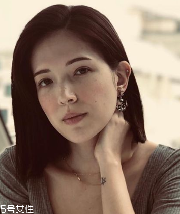 雀斑怎么去除效果好 醫(yī)美去雀斑要注意保養(yǎng) 雀斑怎么去除效果好 醫(yī)美去雀斑要注意保養(yǎng)