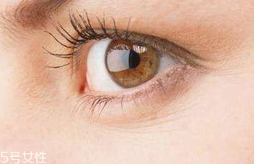 眼角細紋是什么原因 沒想到跟枕頭有關(guān)