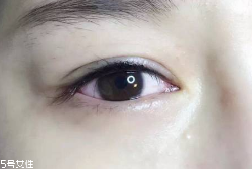 半永久美瞳線位置在哪 相當脆弱的睫毛根部 半永久美瞳線位置在哪 相當脆弱的睫毛根部