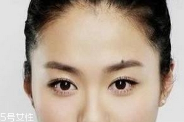 點痣是掛什么科 這個科室才對 點痣是掛什么科 這個科室才對