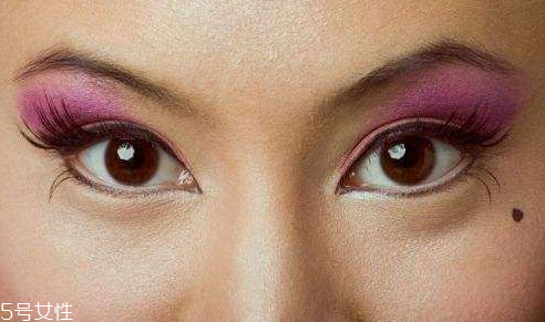 點痣是掛什么科 這個科室才對 點痣是掛什么科 這個科室才對