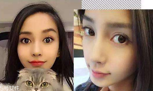 美瞳半年拋可以戴一年嗎 眼睛容易發(fā)炎 美瞳半年拋可以戴一年嗎 眼睛容易發(fā)炎