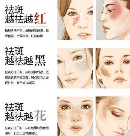 皮秒會(huì)結(jié)痂嗎 正常是會(huì)的 皮秒會(huì)結(jié)痂嗎 正常是會(huì)的