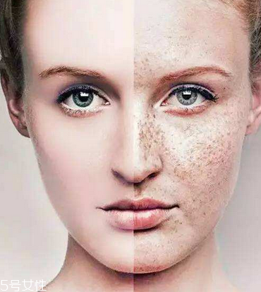 皮秒會(huì)反黑嗎 這是正?，F(xiàn)象