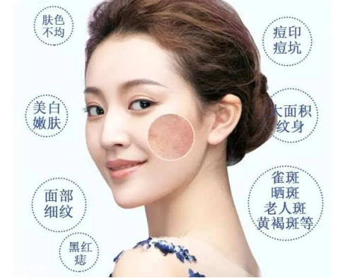 皮秒會(huì)反黑嗎 這是正?，F(xiàn)象