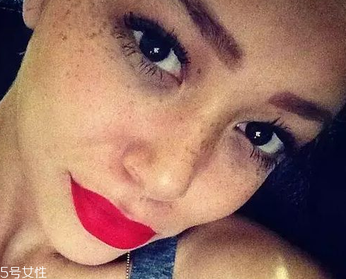 皮秒能去老年斑嗎 這個是必須的 皮秒能去老年斑嗎 這個是必須的