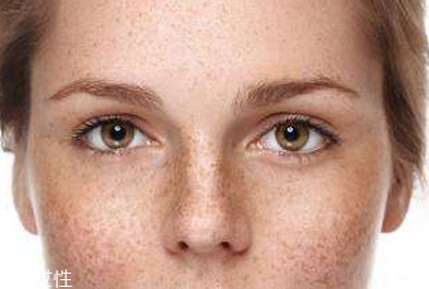 皮秒一次能祛斑干凈嗎 視具體情況而定 皮秒一次能祛斑干凈嗎 視具體情況而定